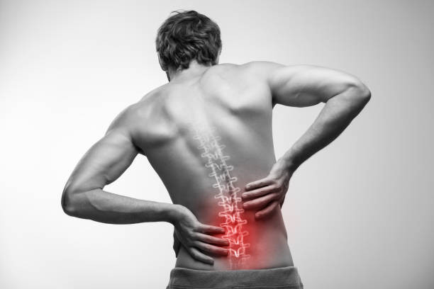 SSDI Benefits for Spinal Stenosis 