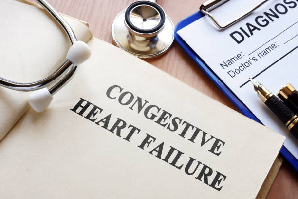 SSDI for Congestive Heart Failure 